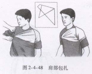 三角巾肩部包扎https://www.zhihu.com/video/1079681287626952704