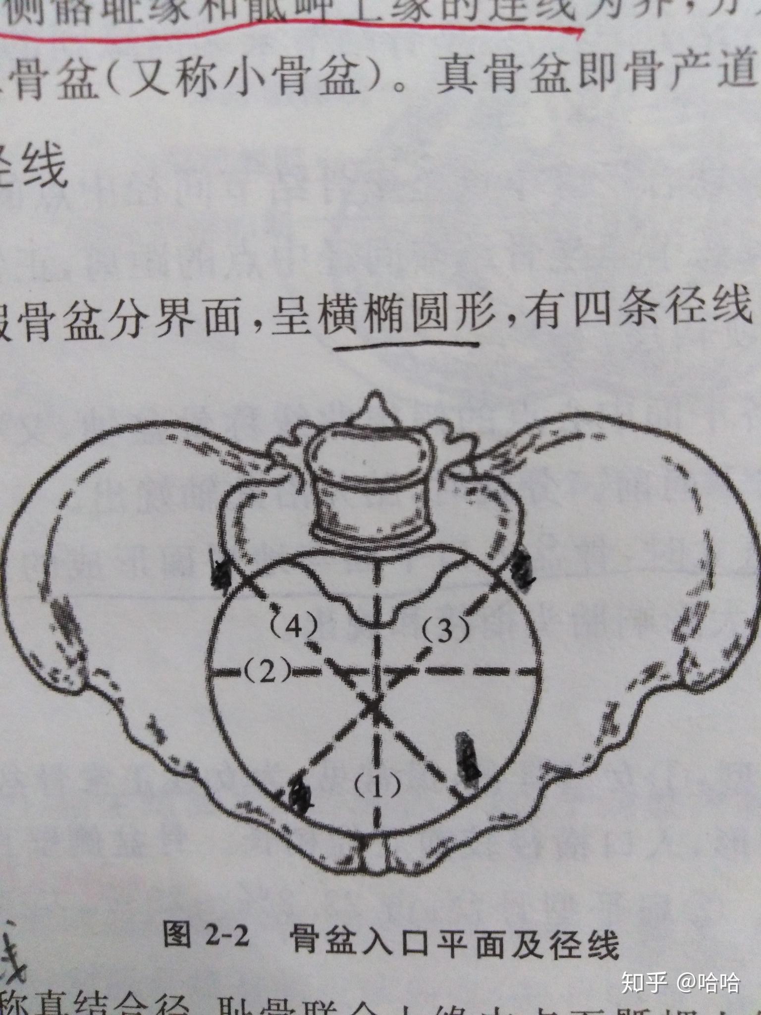 骨盆入口斜径怎么区分左右斜径哪条线是左斜径哪条线是右斜径