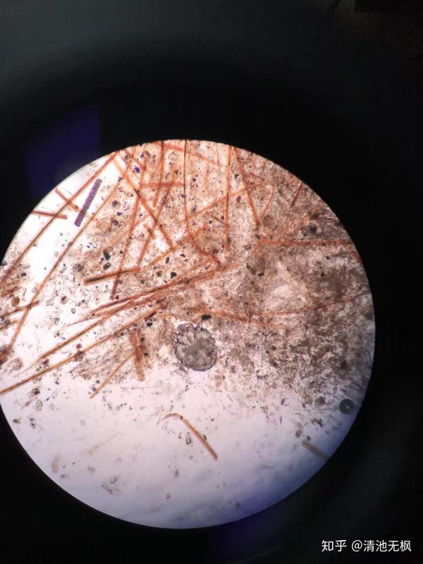 显微镜下的常见虫子