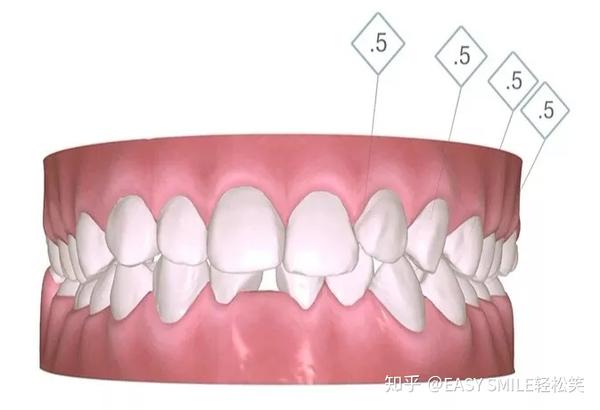 一,牙齿之间的数字代表什么?