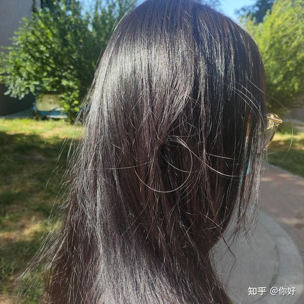 太好看了!我爱了! 你们都有白头发不?咋出来的啊?都好了吗?咋好的啊?