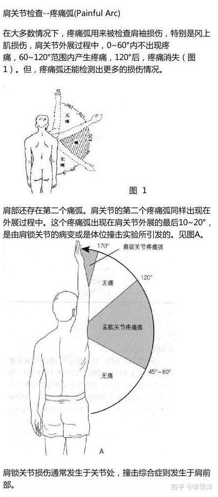 neer 首先提出来的,是指肩部前屈,外展时,肱骨大结节与喙肩弓反复撞击