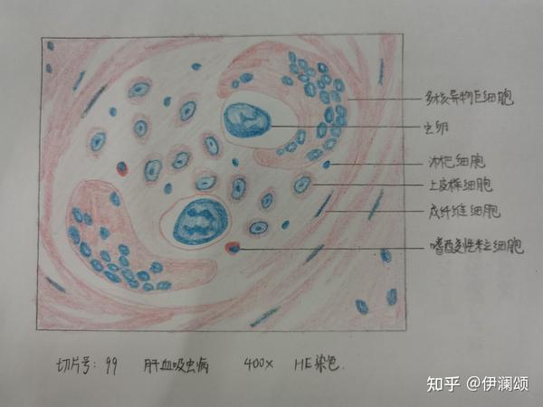 病理实验红蓝铅笔绘图