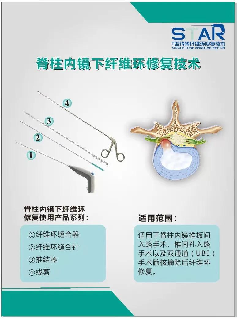 星医百惊骨头可以接纤维环还可以缝合现代医学还有什么做不到的