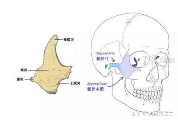 整外医生从业30年分享:颧骨降低和颧弓内推有什么区别