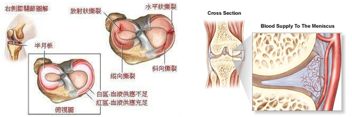 为什么半月板不能自动修复