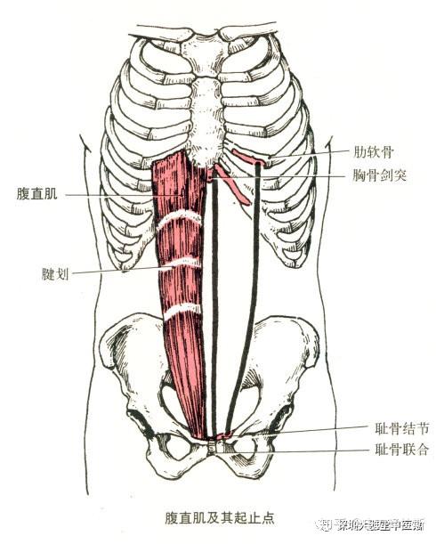 腹直肌起止点示意图