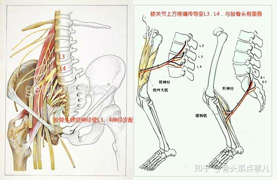 腰疼膝盖疼元凶可能是股骨头坏死