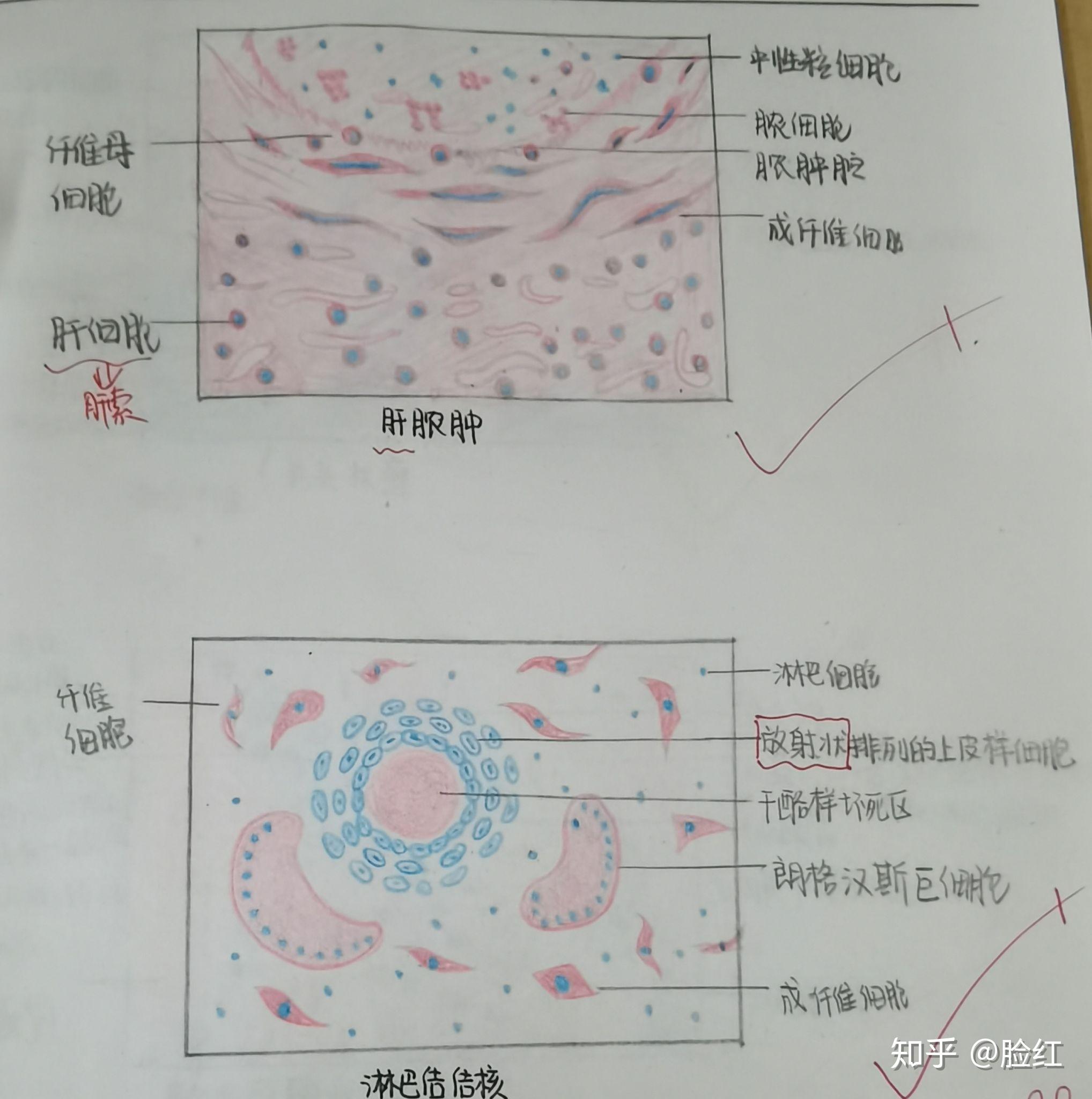 病理学红蓝铅笔绘图