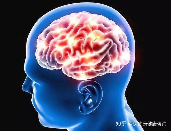 脑梗发作前的三个征兆,出现这些症状要注意了