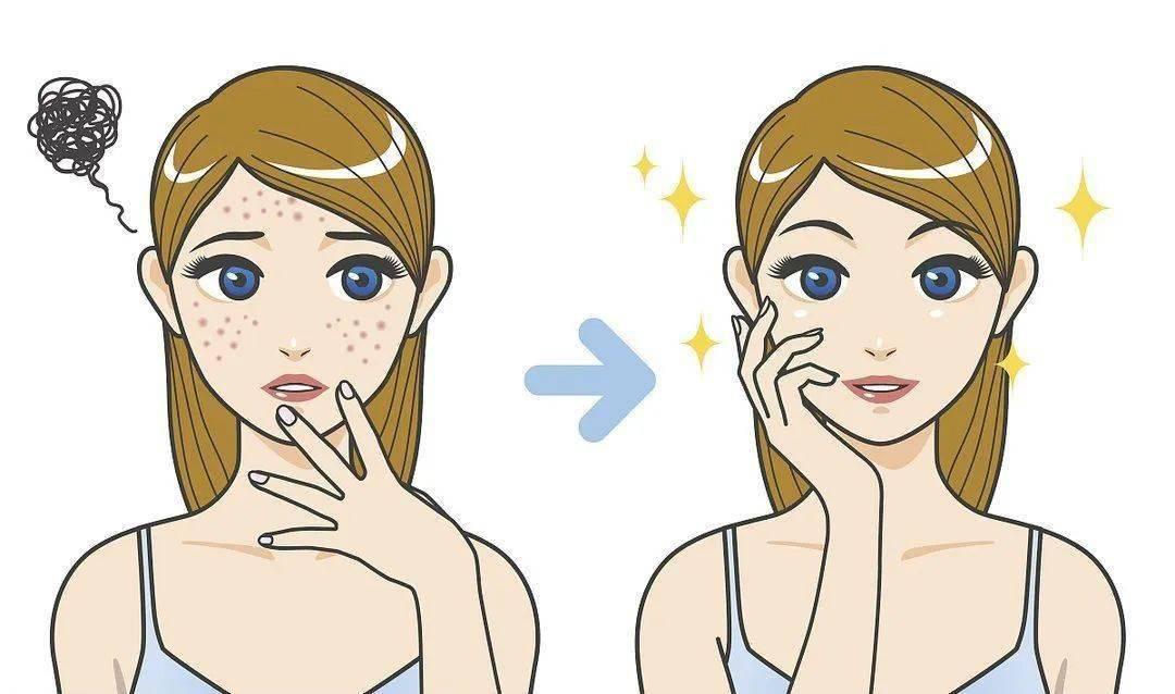 脸部黑头粉刺护理如何护理?