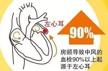 房颤有哪些症状?