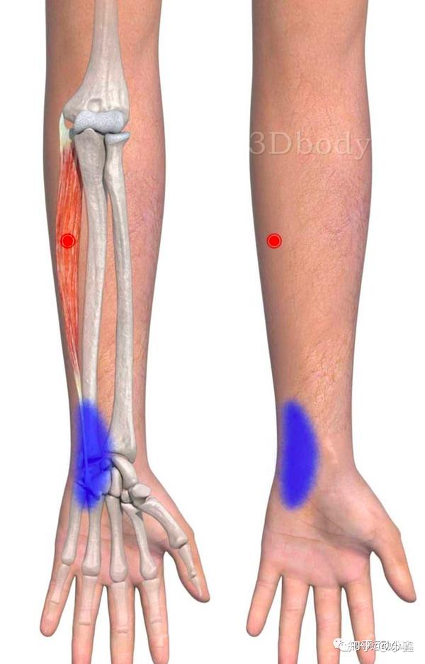 尺侧腕屈肌触发点将疼痛传递到腕部尺侧.