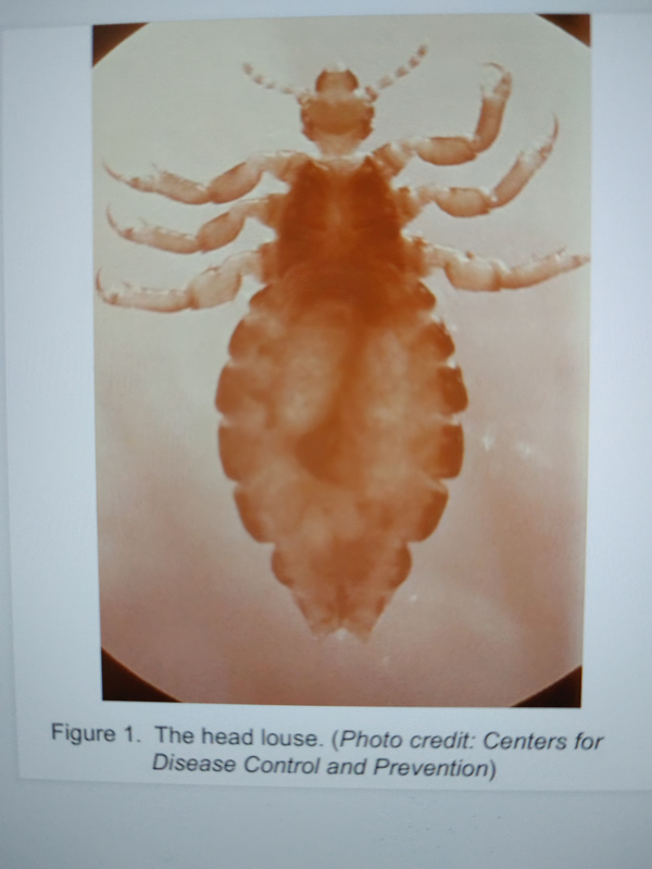 体虱又称衣虱,体长3.5-4mm,灰色或灰白色,体狭长.