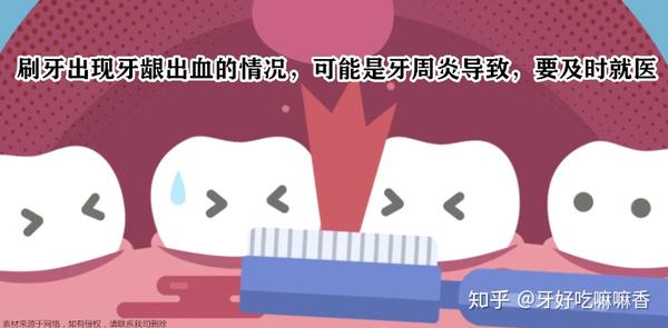 青少年预防牙周炎的方法有哪些?