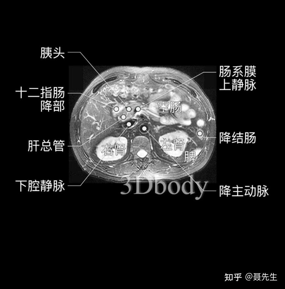 腹部磁共振详细解剖图