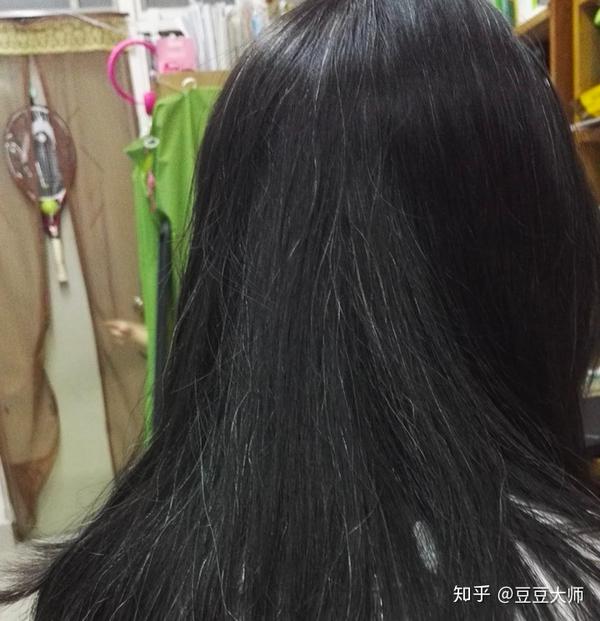 怎么能比较健康地让白发变黑发?