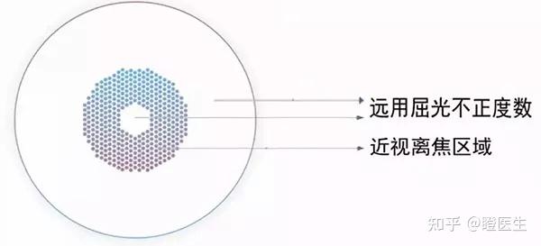 3 星趣控区别多点离焦框架眼镜的优缺点no.1优点1.