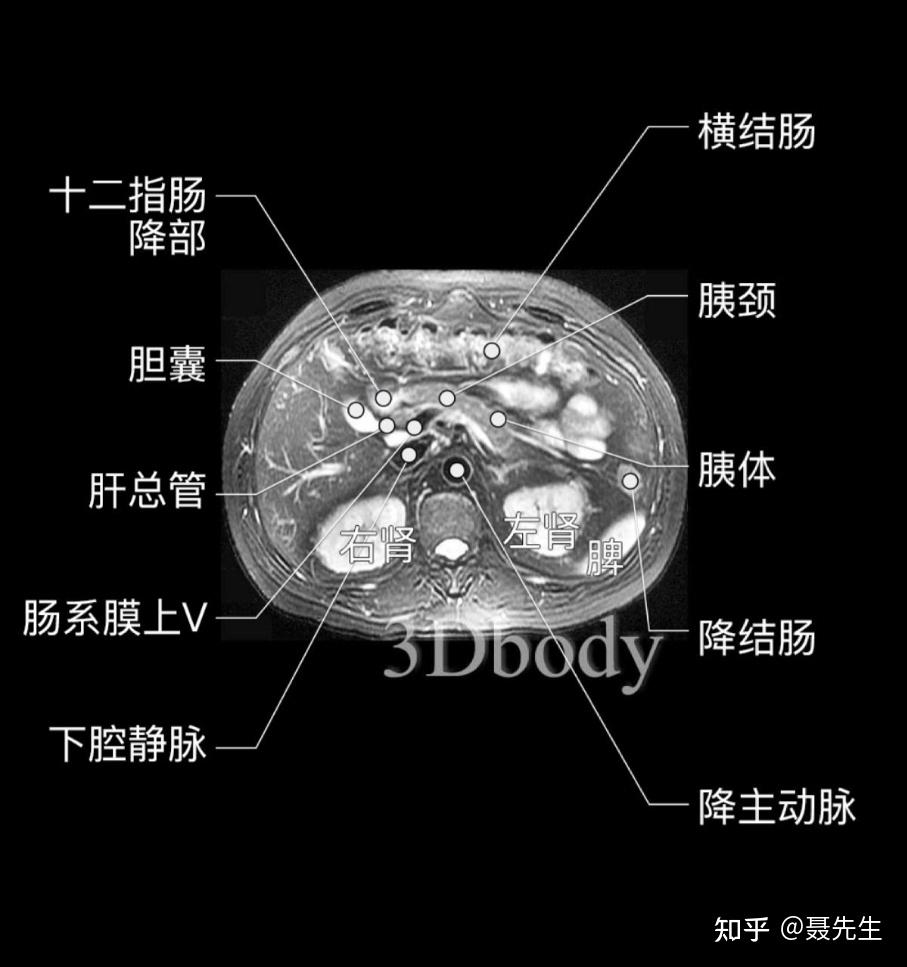 腹部磁共振详细解剖图