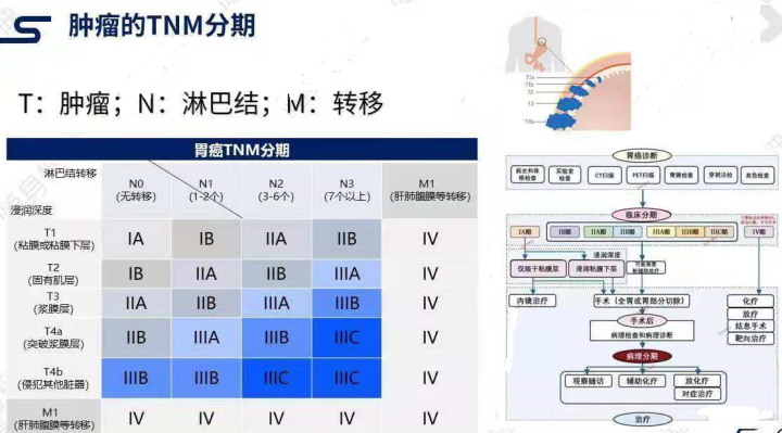 关于癌症什么是肿瘤的tnm分期