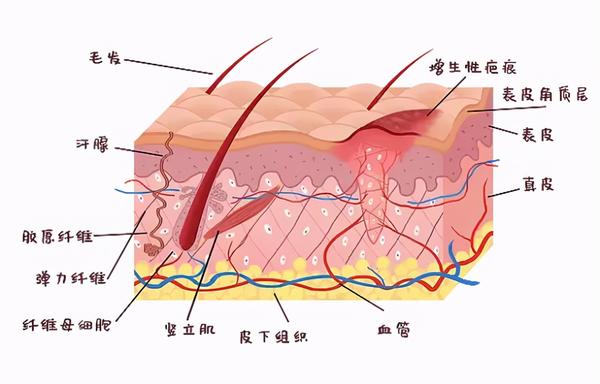 疤痕体质可以做双眼皮吗我是不是疤痕体质啊