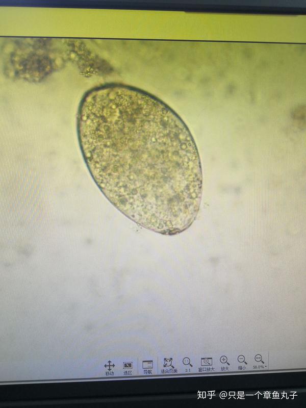 寄生虫部分显微镜下图