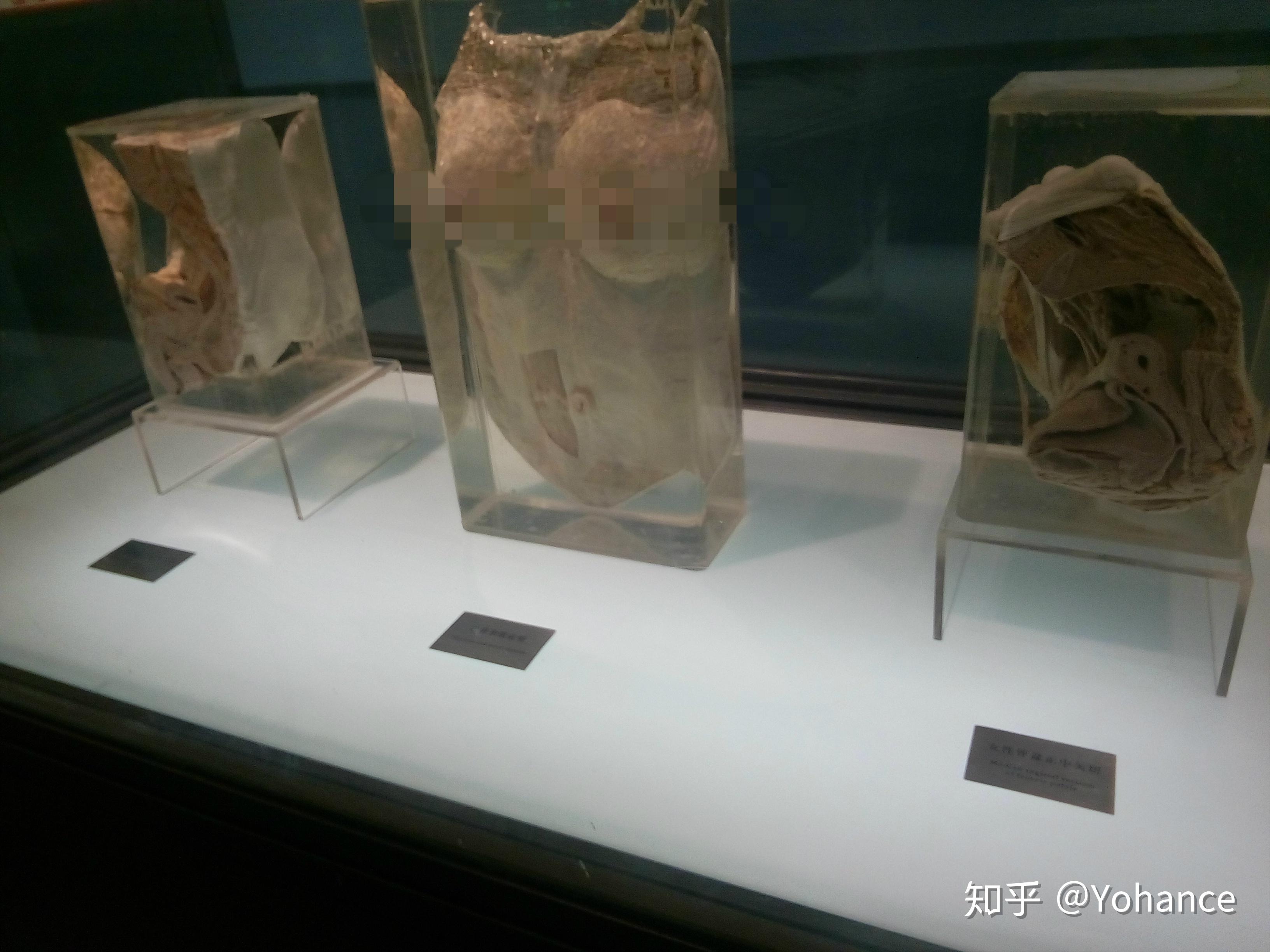 杭州自然博物馆里的人体标本是真的吗