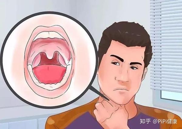 那么,半夜发现口干口苦究竟是什么原因造成的呢?今天,详细科普一下.
