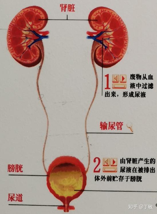 肾结石及治疗攻略 ,良心分享(成因,症状,对策,案例)