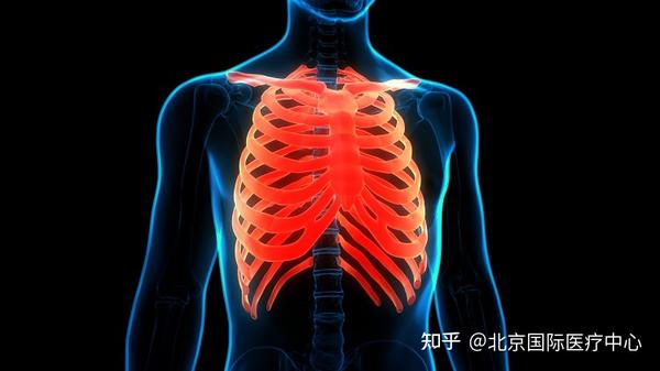 反流性食道炎的胸痛表现为位于胸骨后的烧灼样痛,多在饱餐后平卧位或