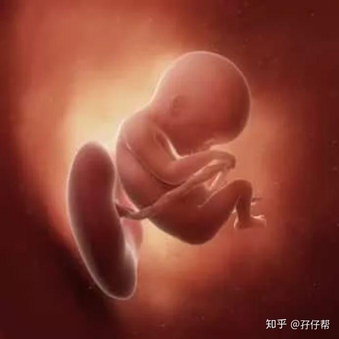b超孕18周的双胞胎胎儿影像图