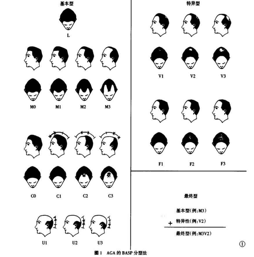 凭什么只有人类会秃