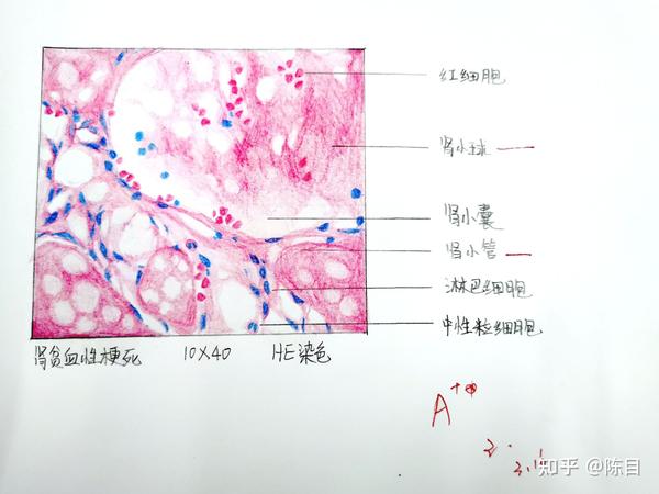 病理 红蓝铅笔绘图