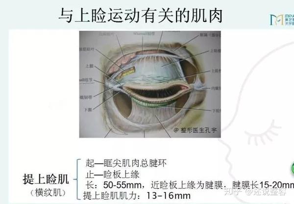 其中最符合人体解剖和睁眼动态的就是提上睑肌.