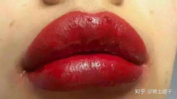 半永久 | 纹唇肿胀,不上色原来都是因为