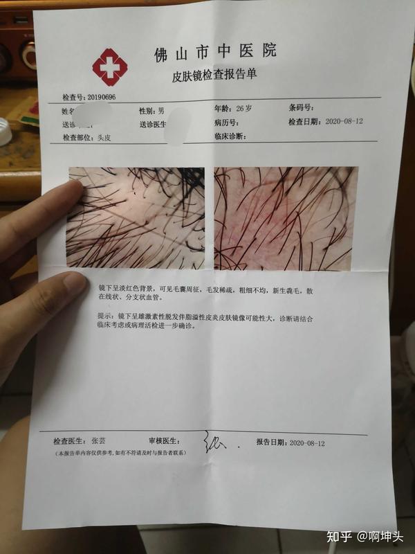 去年佛山中医院毛囊检测报告