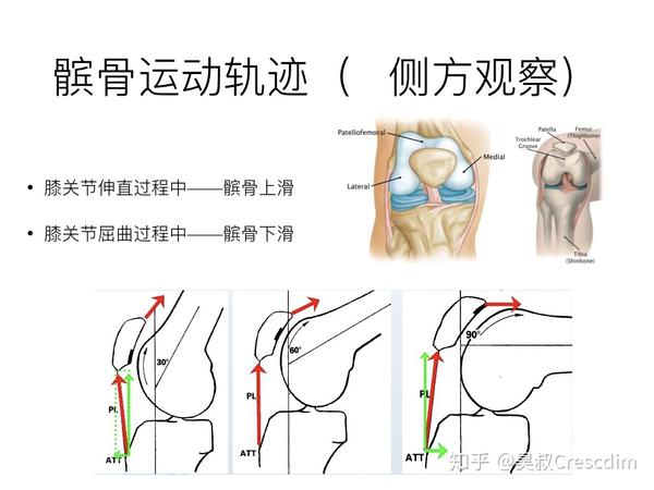 你可以把髌骨想象成火车,而股骨滑车就是铁轨.