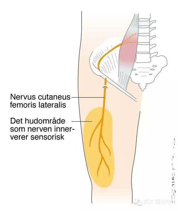 股外侧皮神经损伤答疑