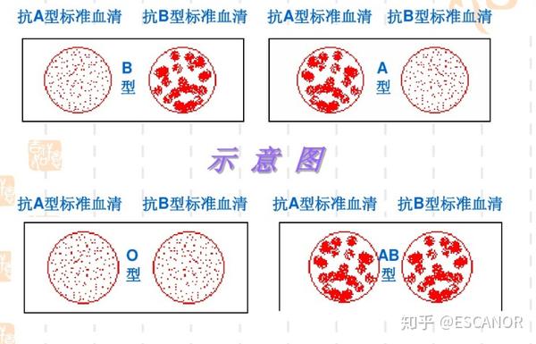 利用玻片法鉴定abo血型 在abo血型中,红细胞膜上有a或者b两种凝集原