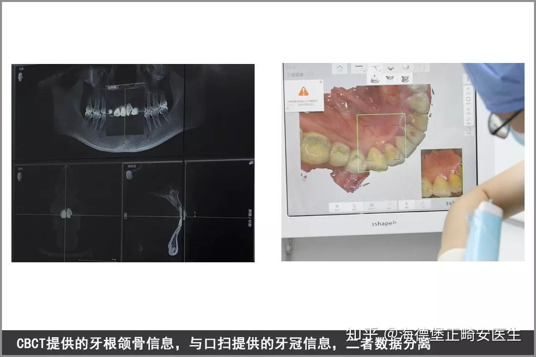 患者说丨女儿的嘴巴变成鸟嘴型妈妈的心有多痛