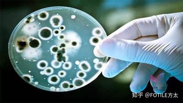 培养皿上的细菌菌落