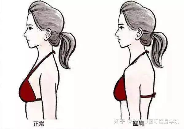 如何纠正圆肩驼背? 伏案族,手机党的必修指南!