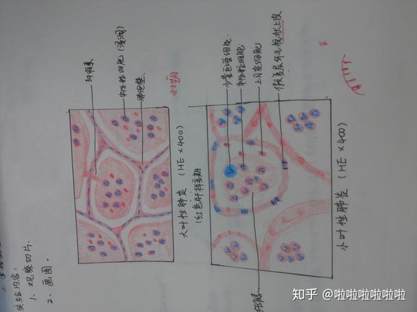 病理学切片红蓝铅笔画