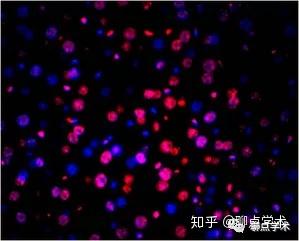 tunel荧光染色分析的本质是一个计数问题,即通过计数凋亡细胞核的数量