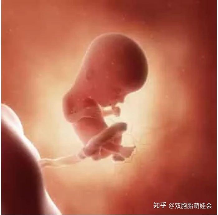 b超孕13周的双胞胎胎儿影像图