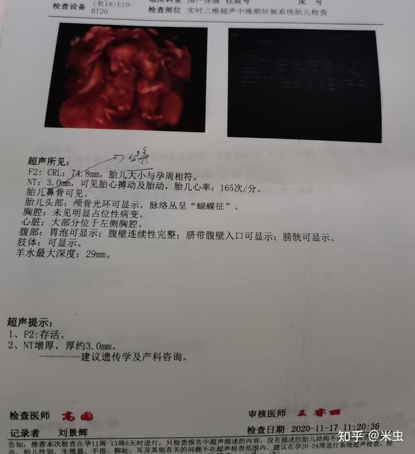 再见了我的双胞胎宝宝