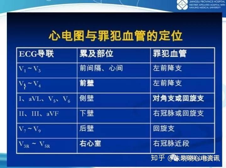 心电图定位心肌梗死相关血管