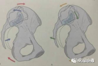 体态矫正之骨盆前倾