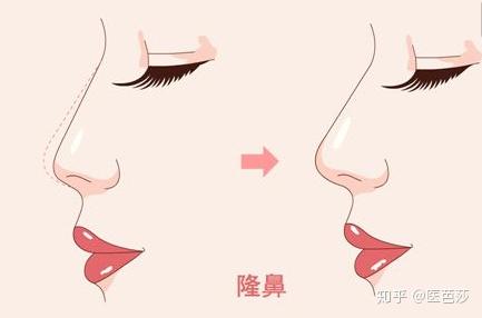 《90后单身人群白皮书》:30岁,因长得丑单身,先隆鼻还是先祛斑