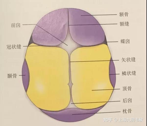 什么是颅缝早闭,危害到底有多大